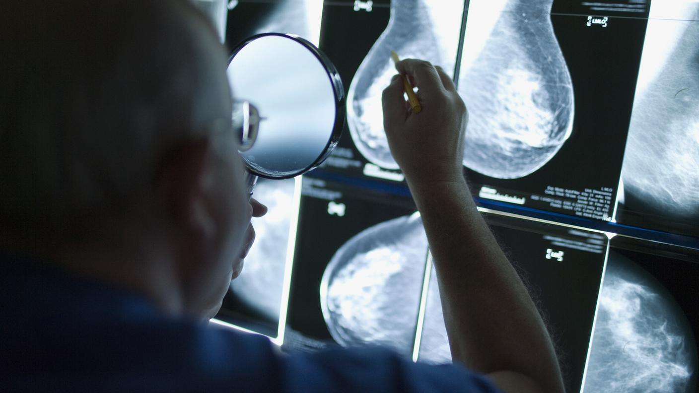 Il software ha dimostrato di avere un'accuratezza nella diagnosi paragonabile a quella di radiologi esperti