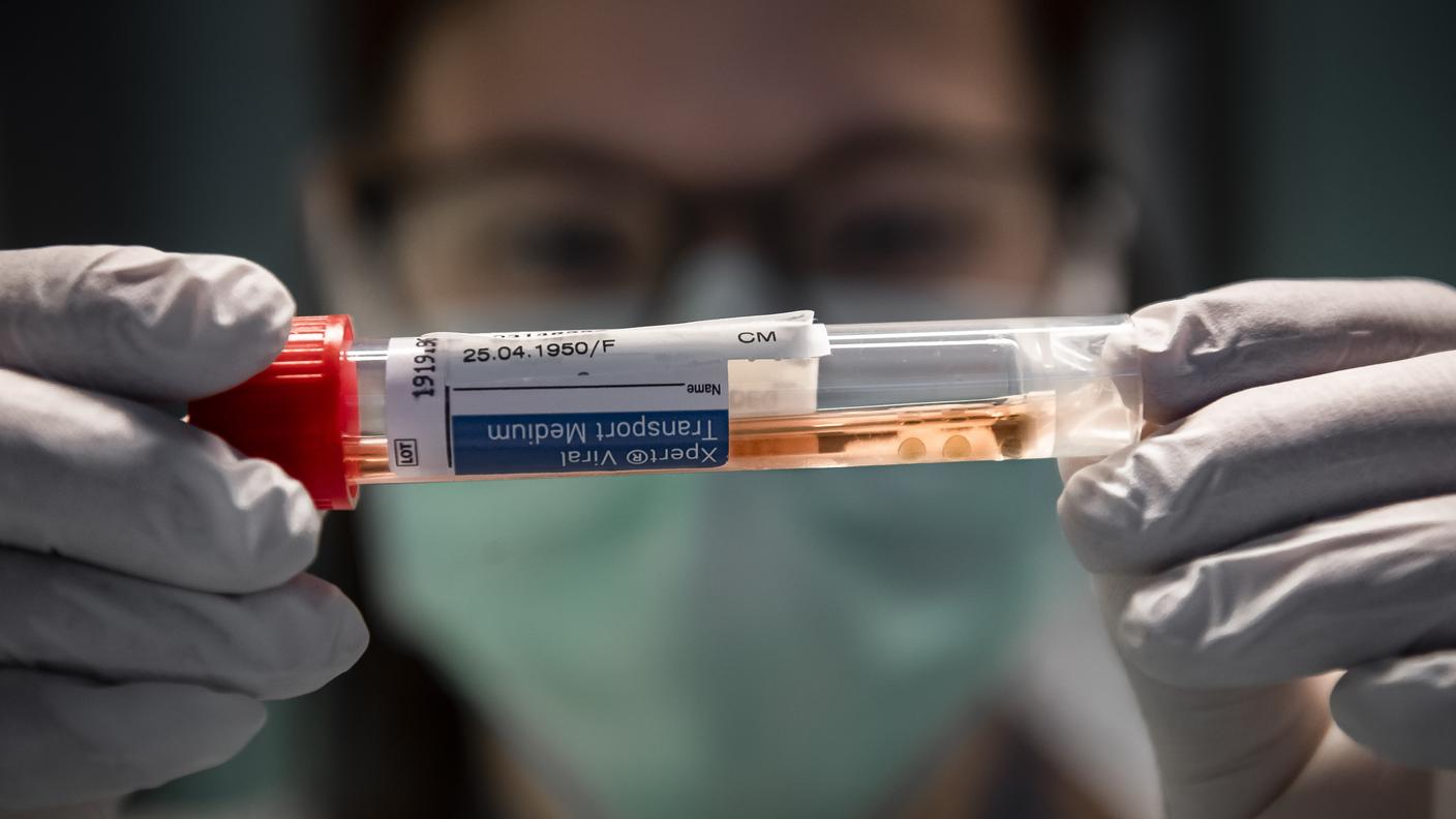 Il passo successivo è il sequenziamento del virus