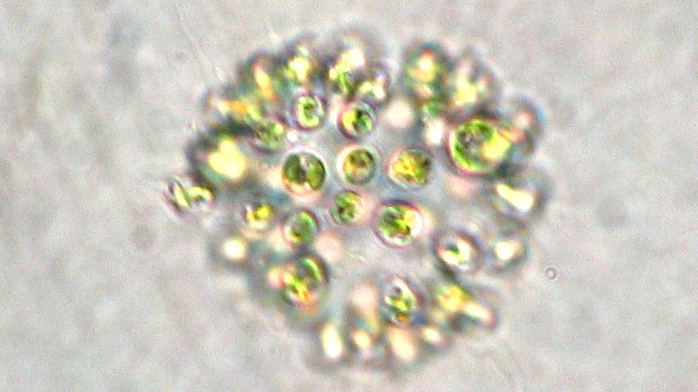 Microcystis Aeruginosa