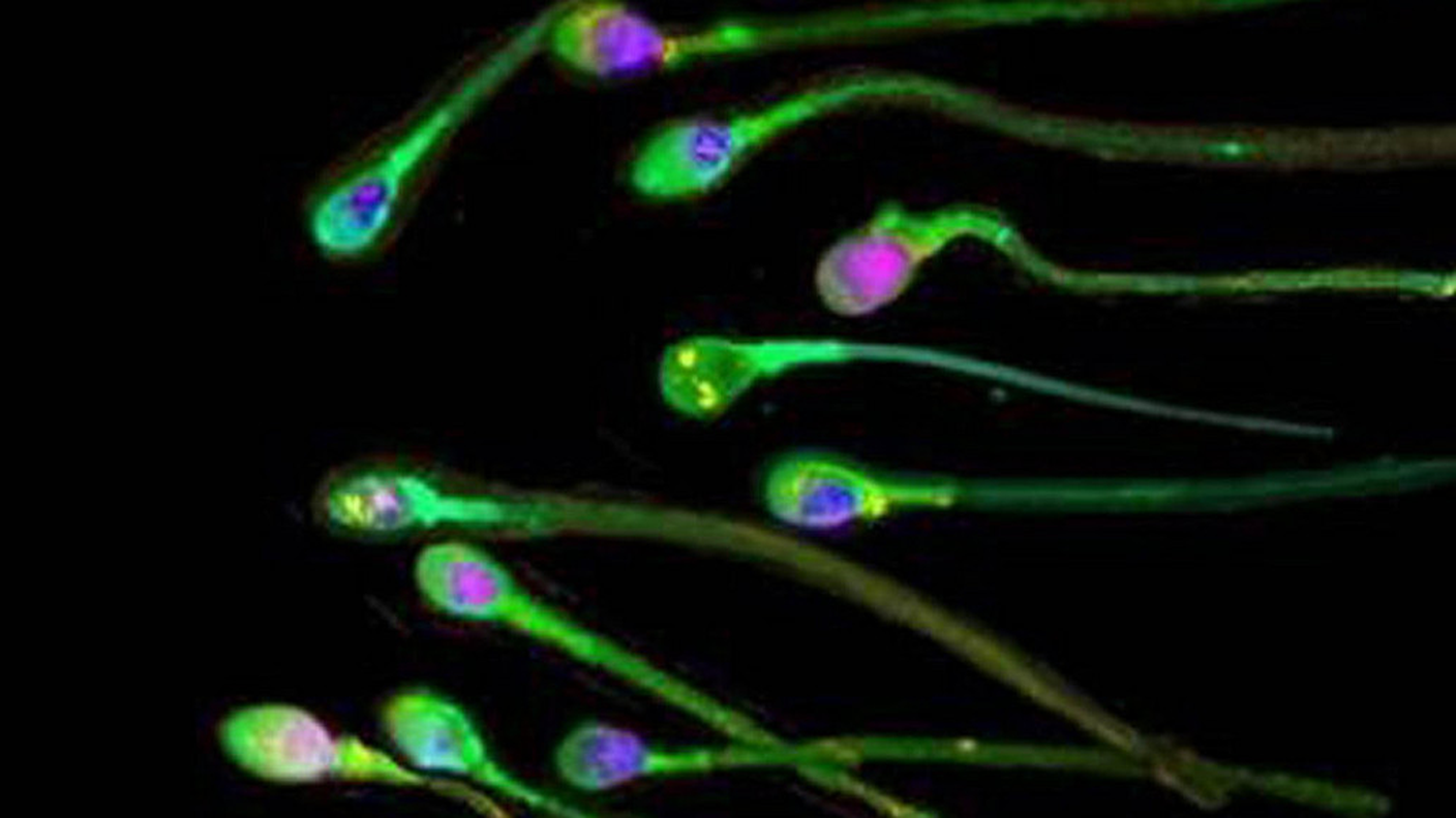 Gli spermatozoi potranno in futuro essere aiutati nel loro tragitto