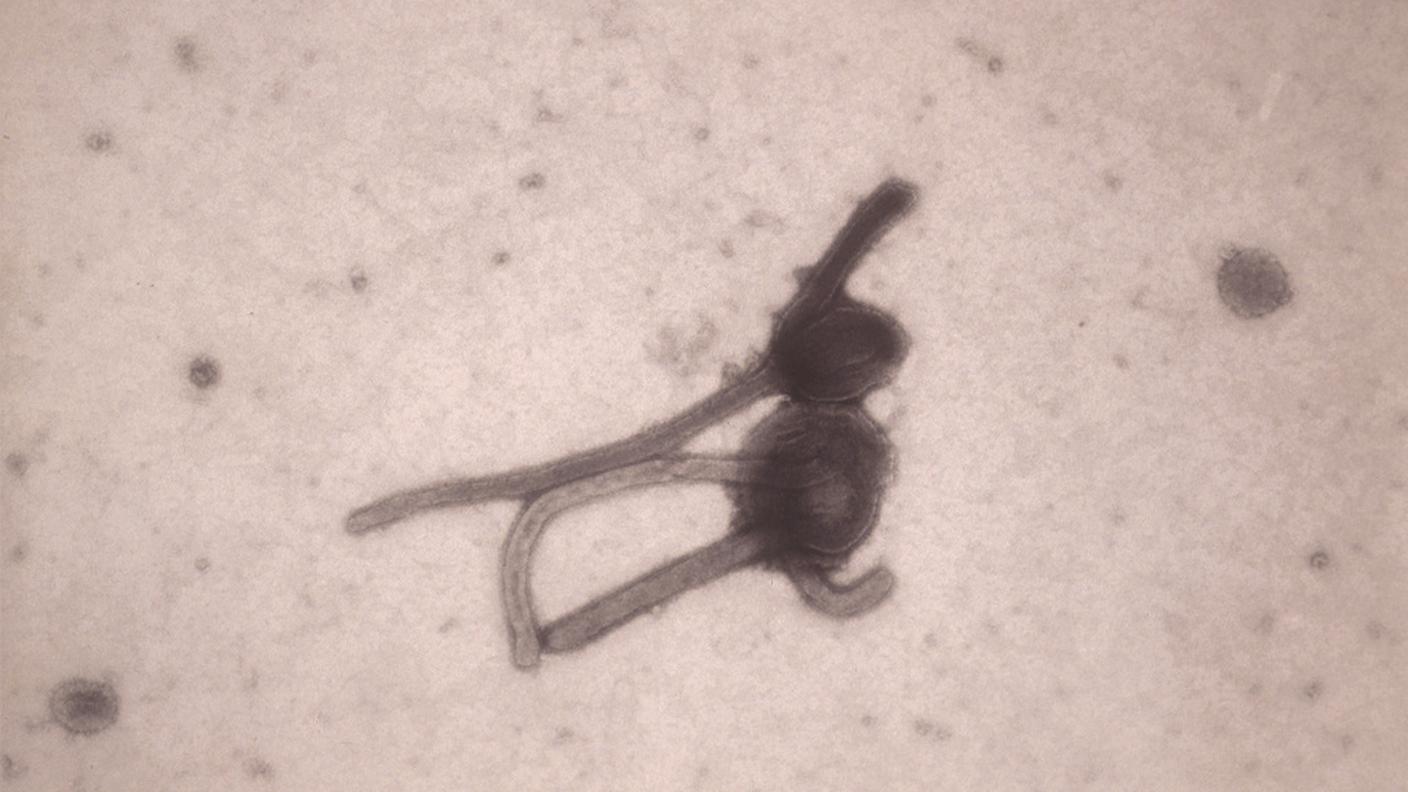 Il virus visto attraverso un microscopio