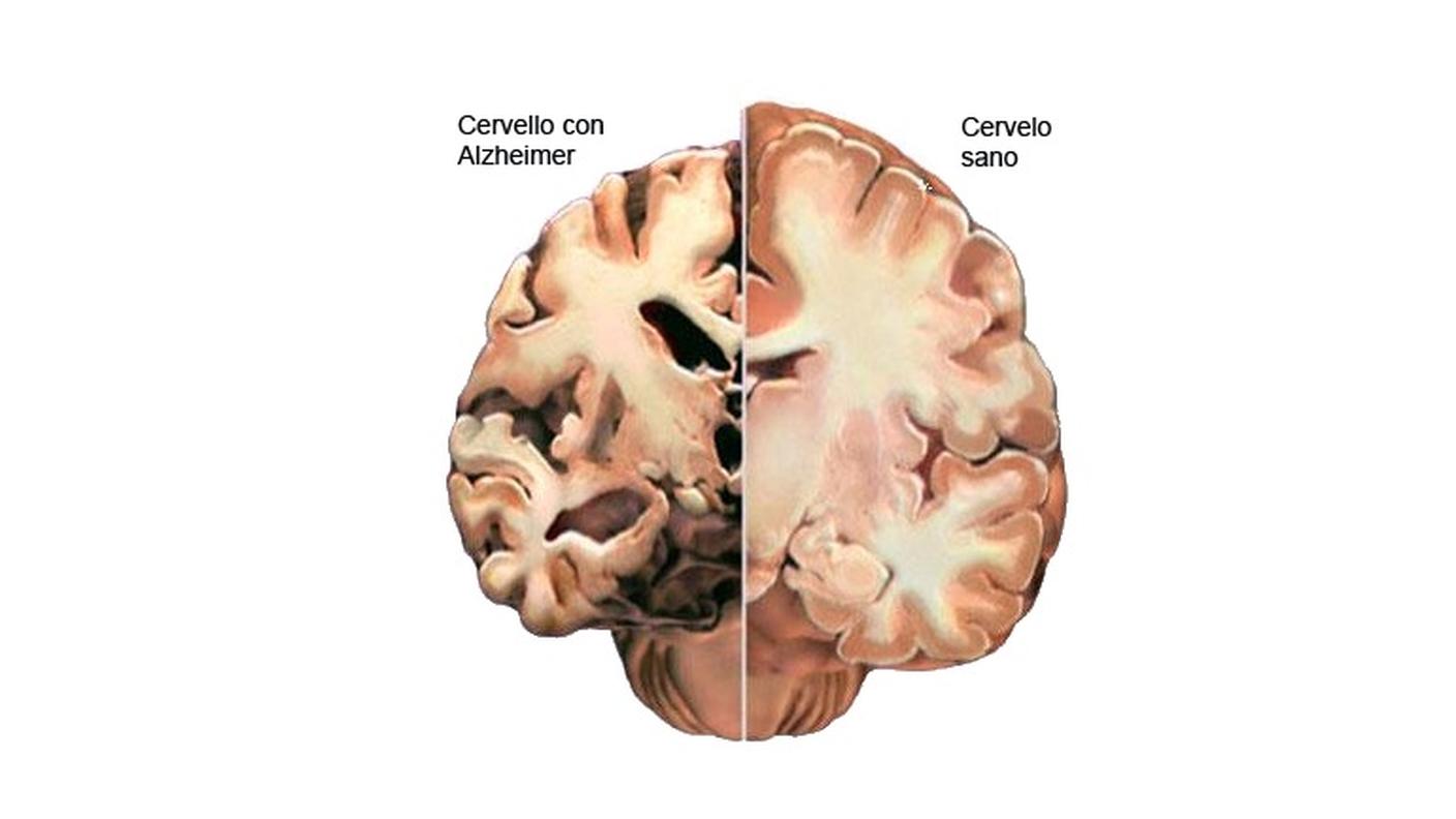 Ravvivare il cervello è possibile