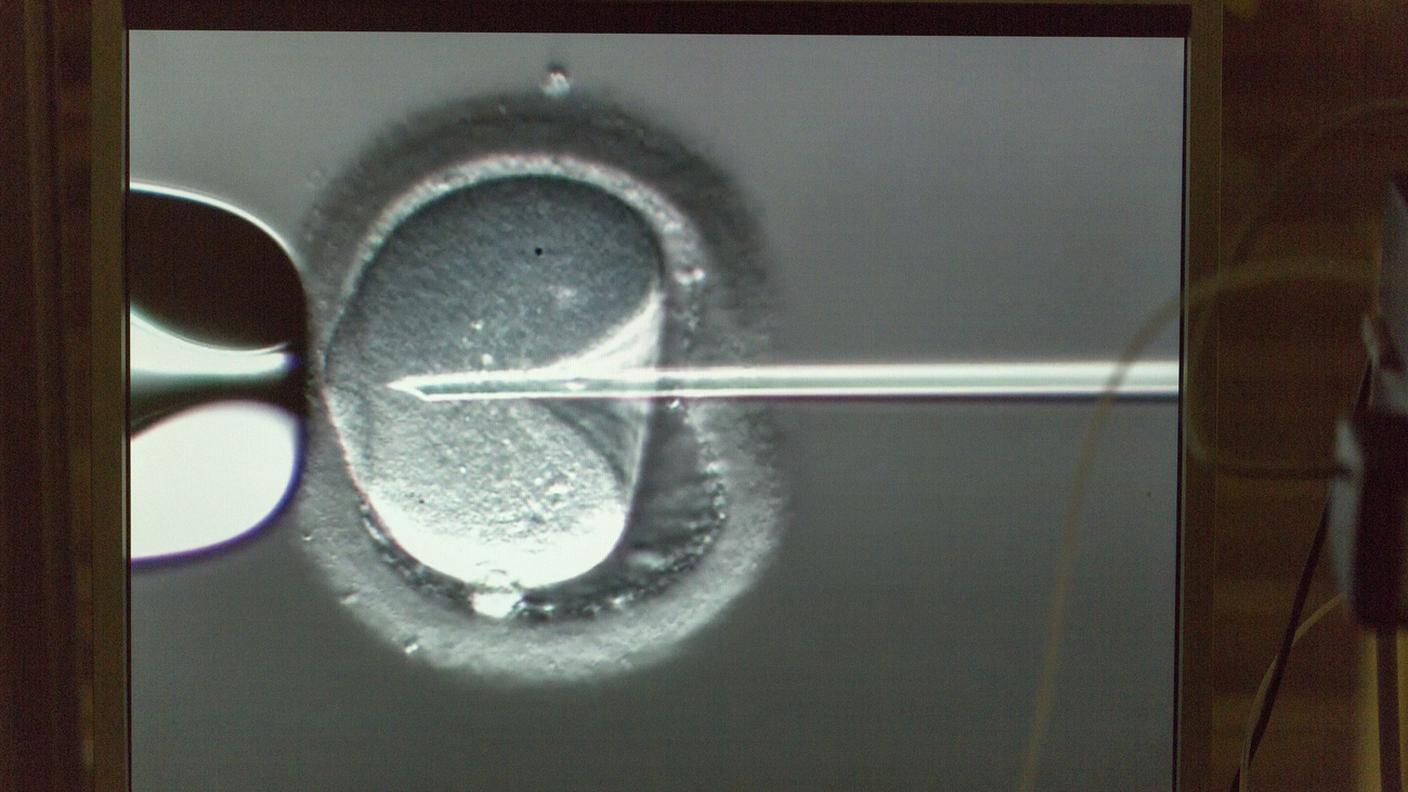 Attualmente, la donazione di sperma è consentita solo per le coppie sposate, mentre la donazione di ovuli è completamente vietata