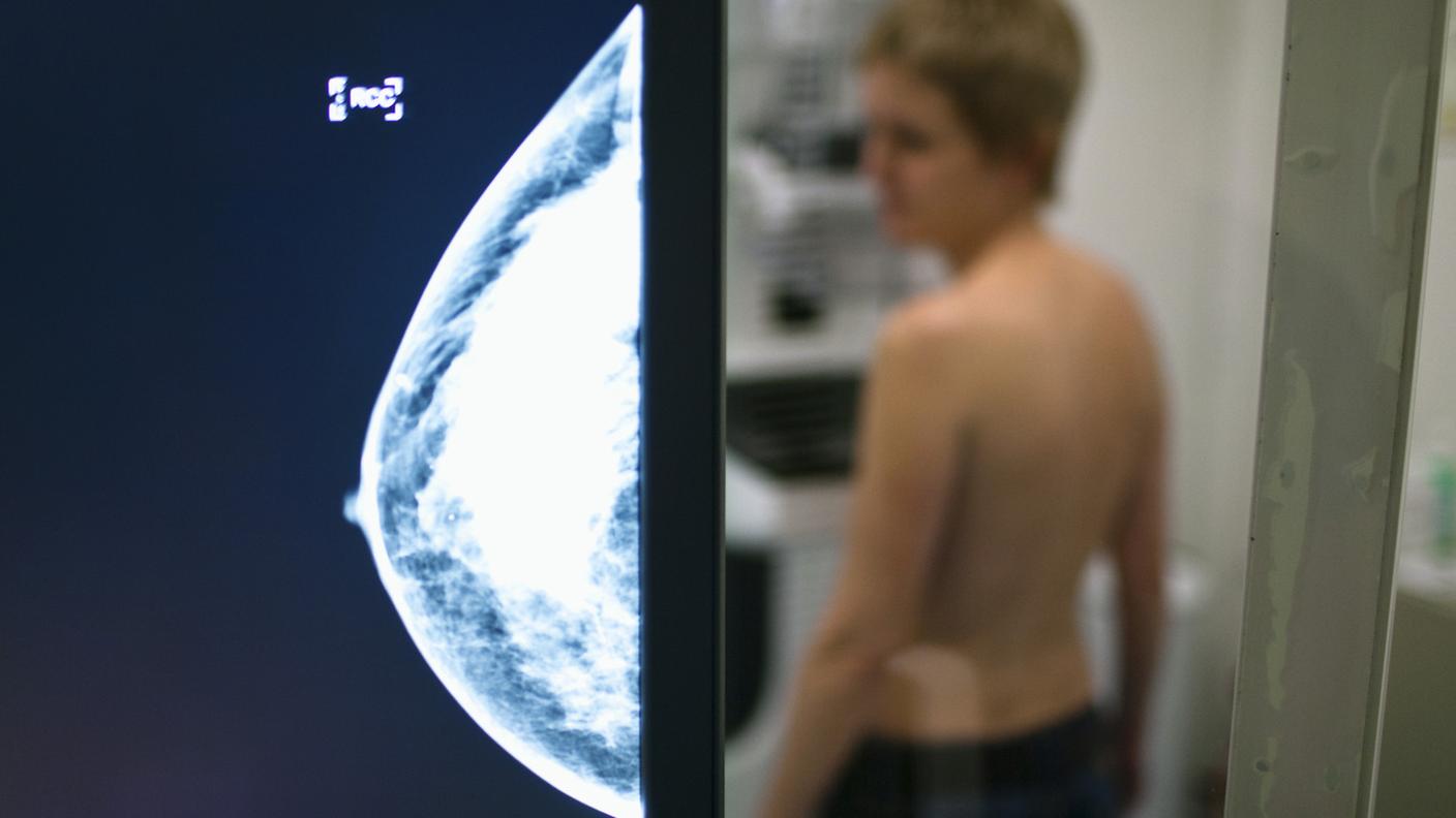 Iniziare lo screening mammografico prima consente una diagnosi più precoce, riduce la necessità di trattamenti costosi e prolungati e migliora la qualità di vita delle pazienti