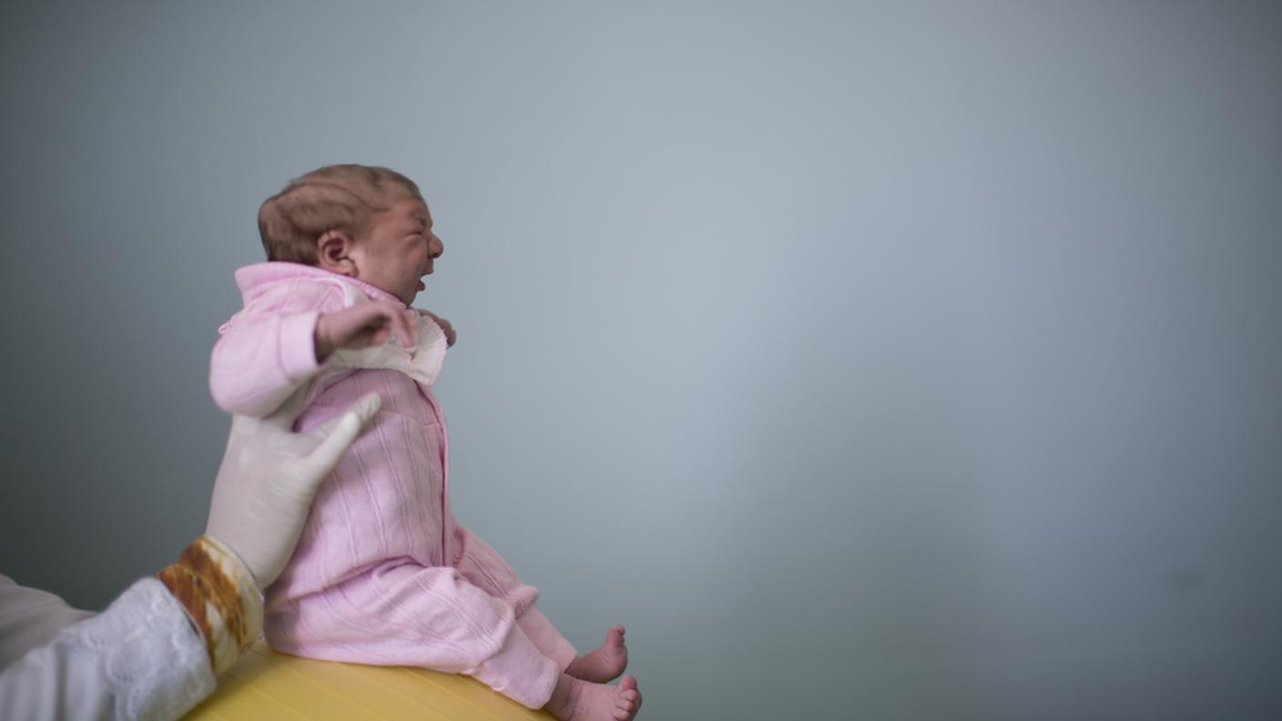 Un bimbo affetto da microcefalia nato in Brasile