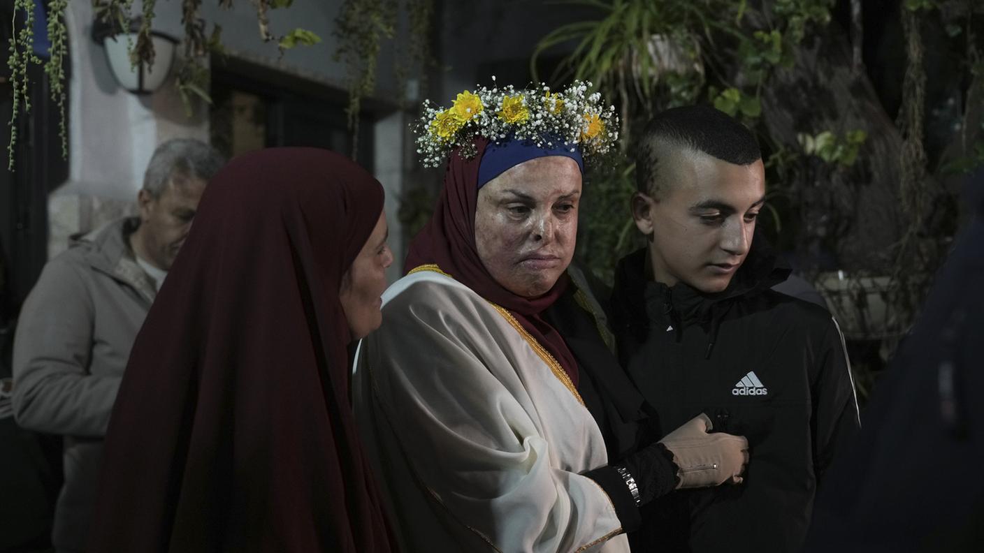 Israa Jaabis insieme al figlio
