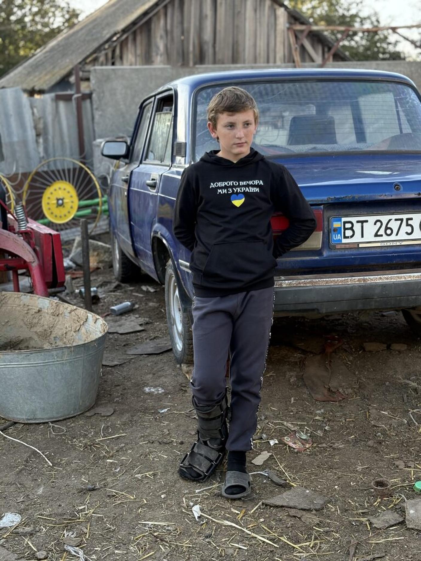 Ivan, 11 anni, è stato ferito da una mina
