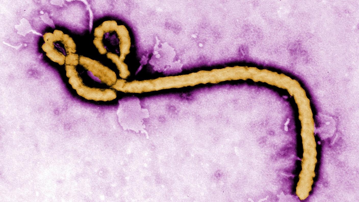 Il temibile virus, qui inquadrato da un microscopio elettronico