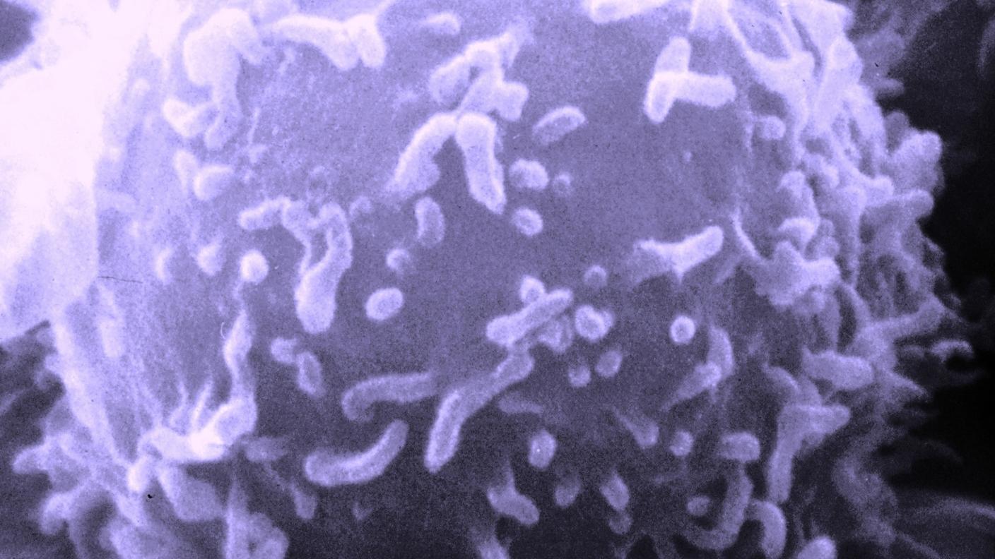 Un linfocita al microscopio elettronico