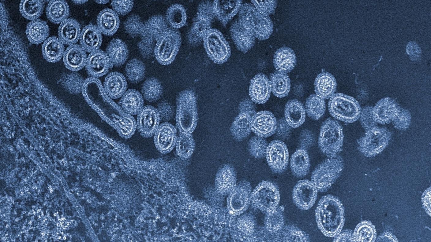 Ceppo H7N9 del virus dell'influenza aviaria
