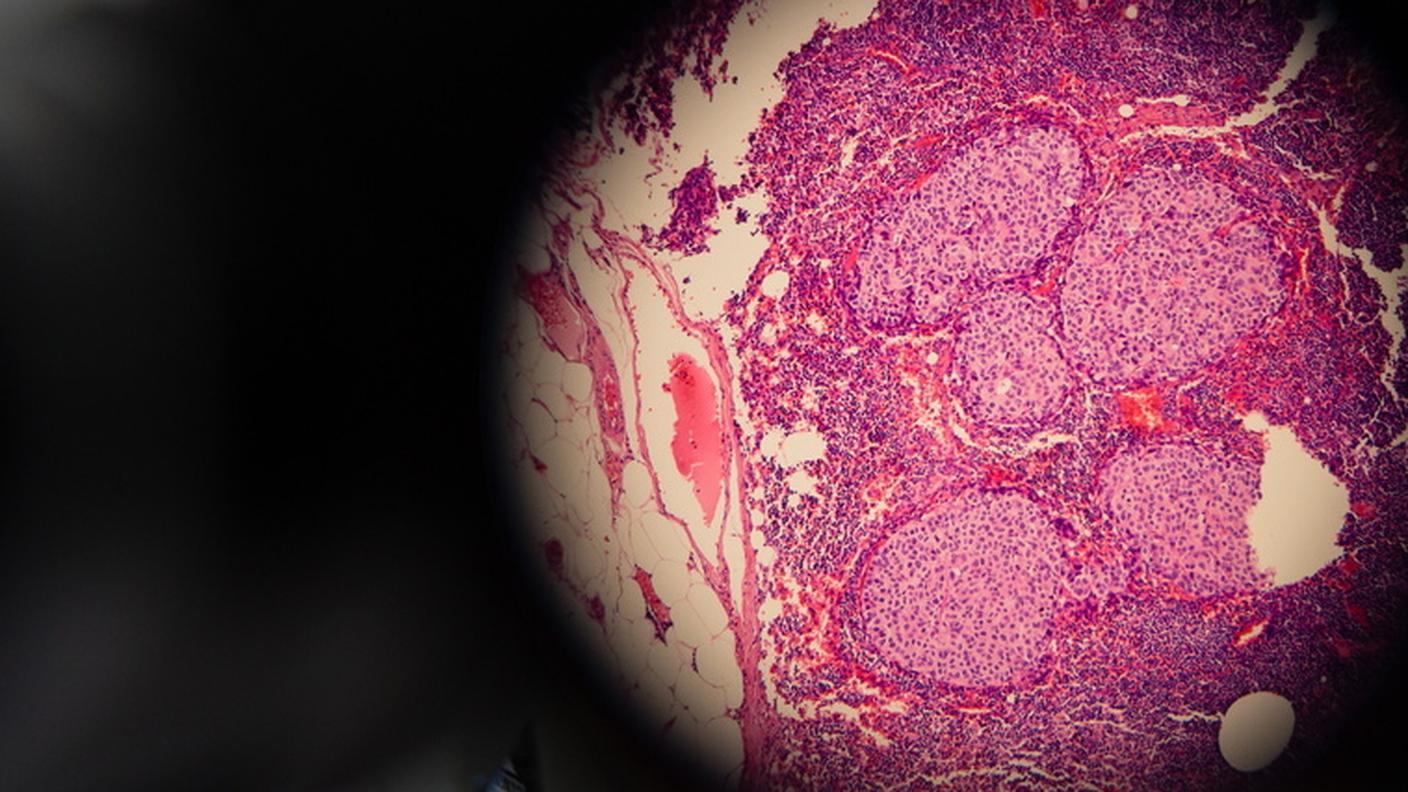 Tra quasi 7'000 sostanze esaminate, l'algoritmo ha trovato in meno di due ore la molecola idonea per produrre l'antibiotico