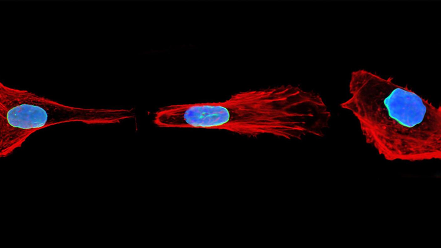 Cellule durante la migrazione in un canale ristretto nella configurazione estesa (ai lati) e compatta (in centro). In blu è rappresentato il nucleo della cellula, dove risiede in DNA, in rosso l'actina, una delle proteine che compongono il citoscheletro, la struttura della cellula.
