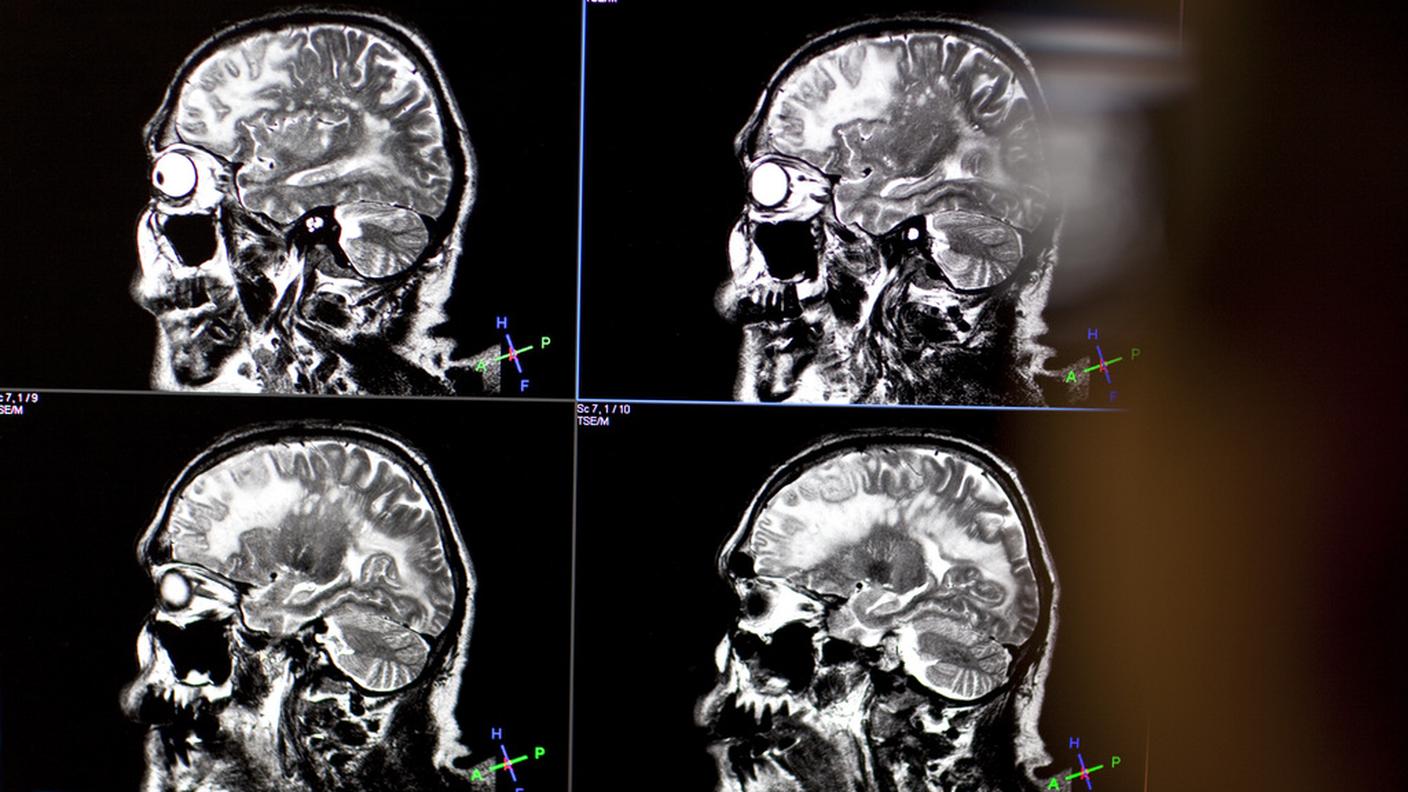 Una nuova scoperta sul cervello umano
