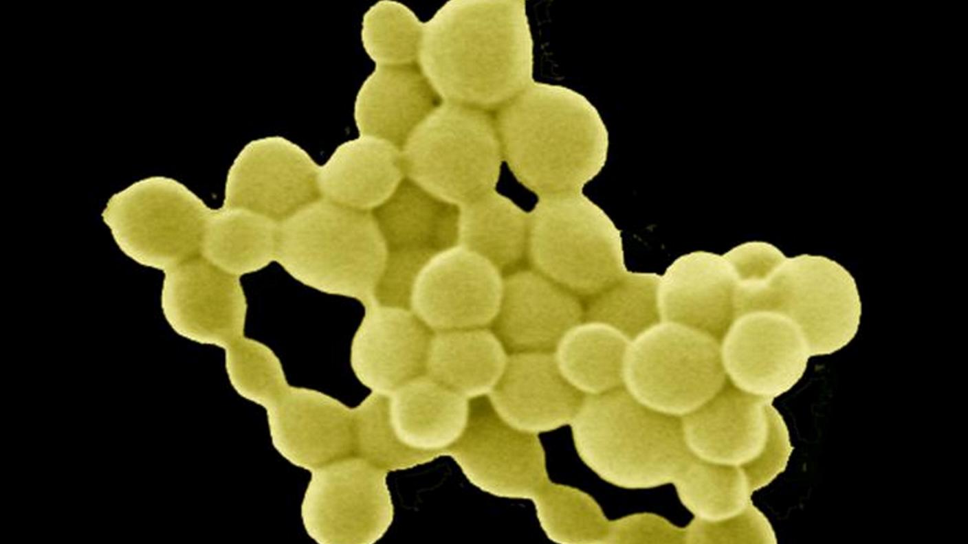 Le "pepite d'oro" generate dai batteri C. metallidurans
