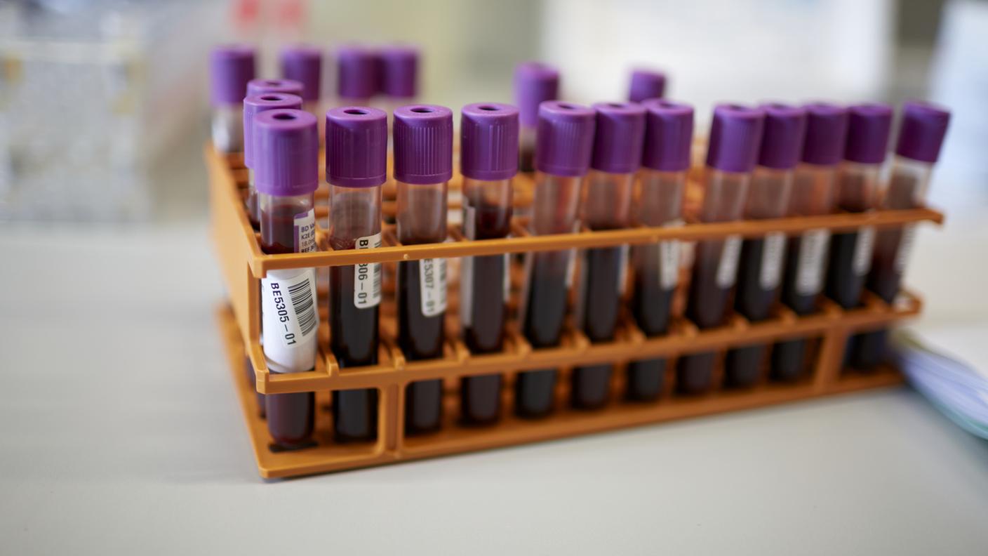 Il numero di test per rintracciare l'eventuale presenza del virus è cresciuto dell'11%