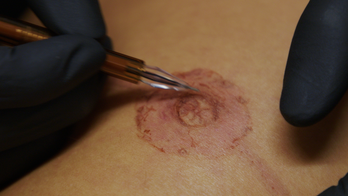 Disegno a mano libera del complesso areola-capezzolo (Giulia Raccagni)