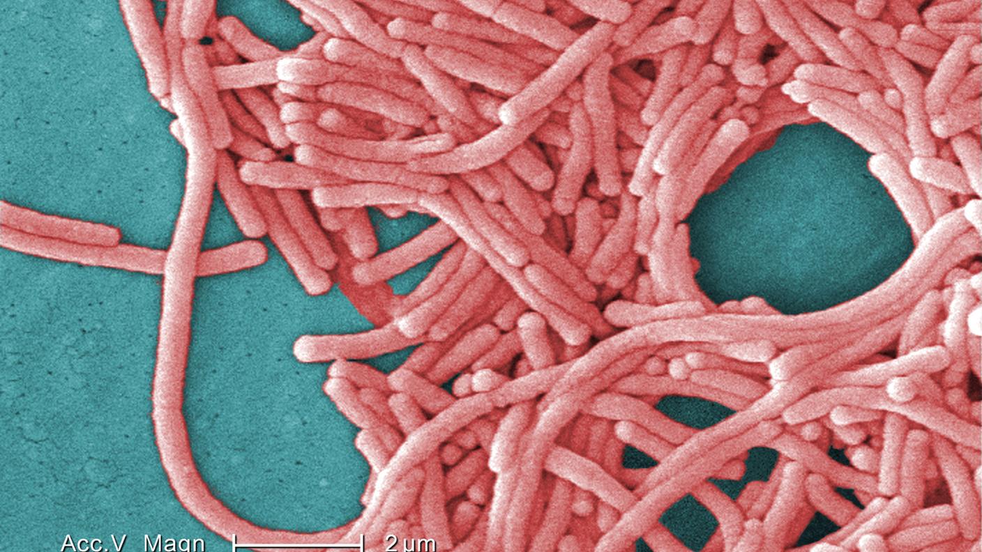 Il batterio Legionella prospera nell'acqua stagnante