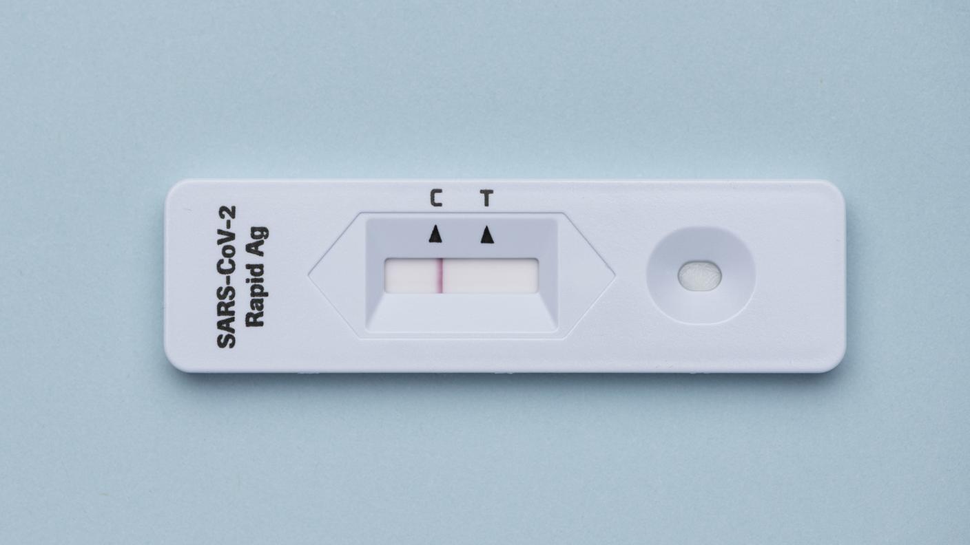 I prezzi fissati permettevano di coprire i costi ai laboratori più piccoli, ma per le grandi strutture automatizzate erano troppo alti e hanno generato utili eccessivi per diversi milioni di franchi