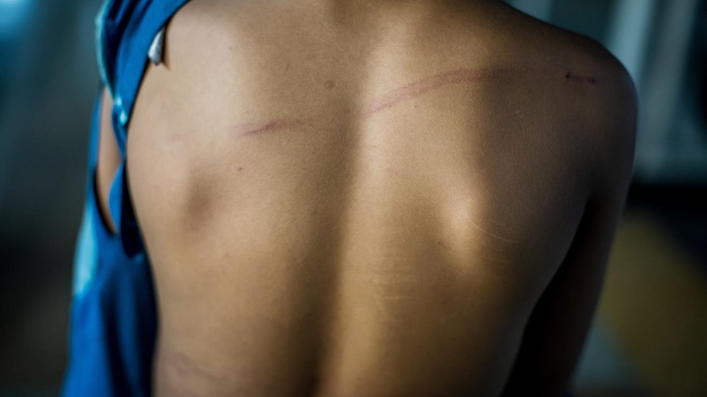 Ogni caso di sospetta violenza viene valutato e seguito dalle équipe specializzate dell'ospedale pediatrico e, se del caso, da servizi esterni