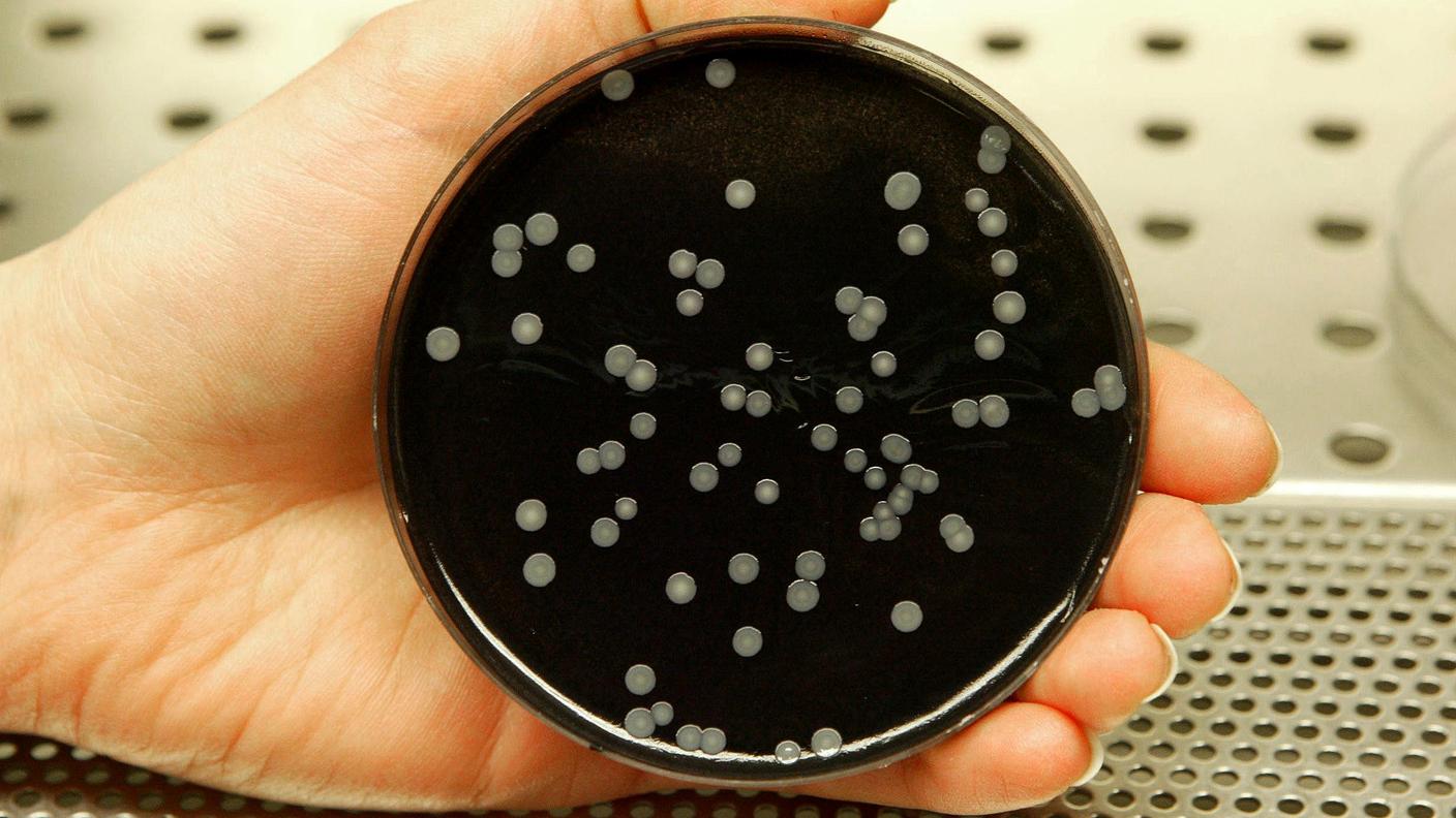 Ecco come si presenta una coltura batterica di legionella in laboratorio