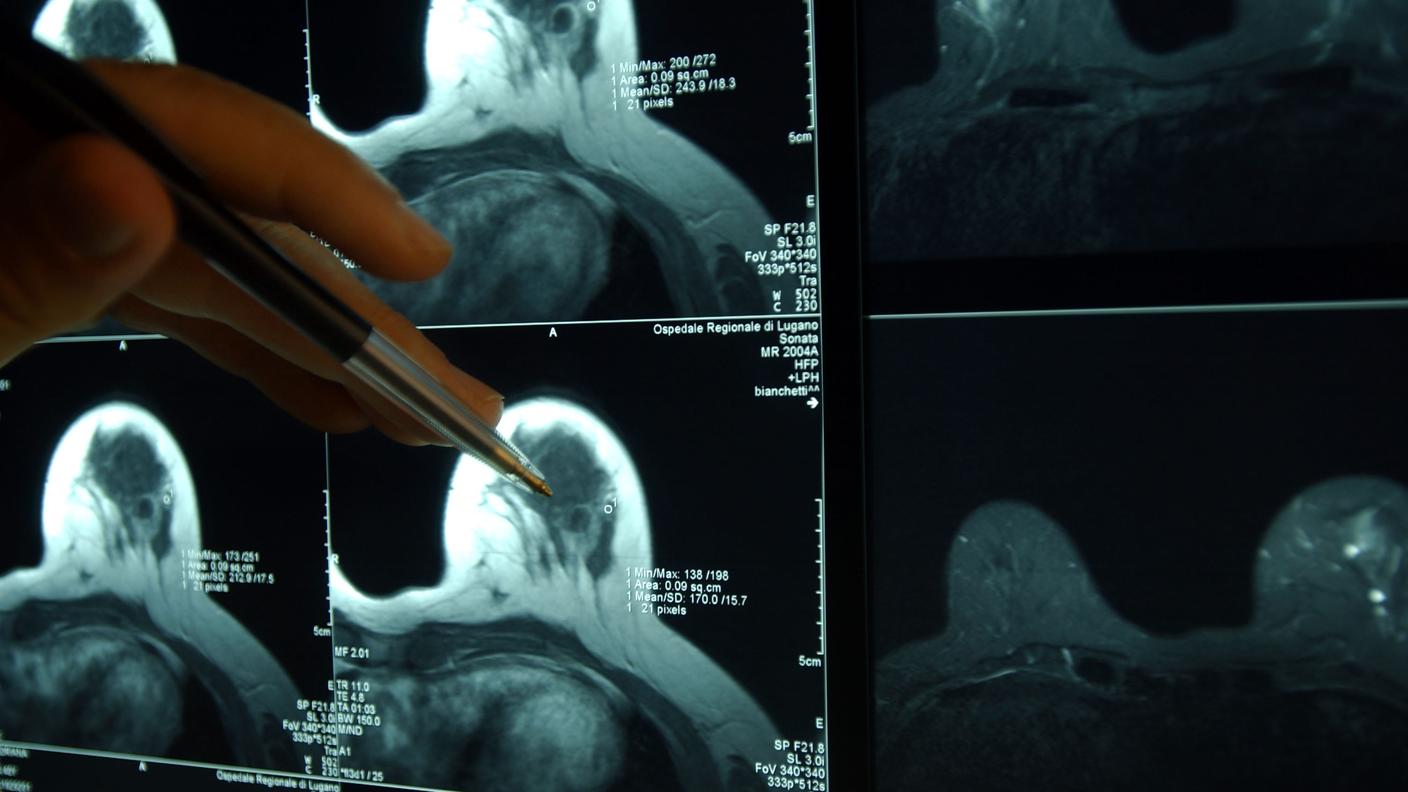 Il difensore della paziente hanno già fatto l’annuncio d’appello