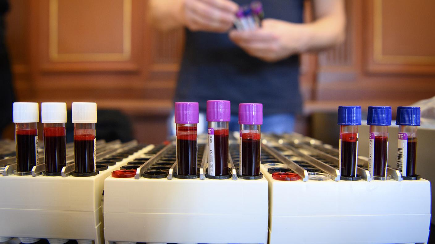 Alcuni campioni di sangue per l'analisi degli anticorpi contro il Covid-19