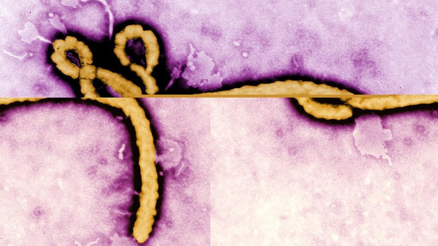 Il virus Ebola è un agente patogeno estremamente contagioso e letale